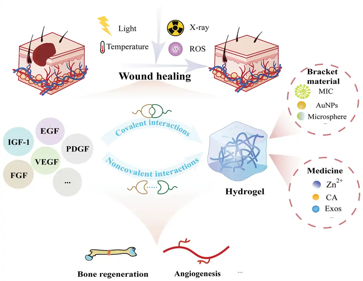 Representative figure for Smart responsive hydrogel-based growth factor delivery systems: precise release and synergistic regeneration strategies for wound healing